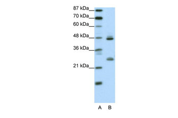 KLF6 Rabbit Polyclonal Antibody