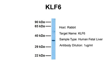 KLF6 Rabbit Polyclonal Antibody