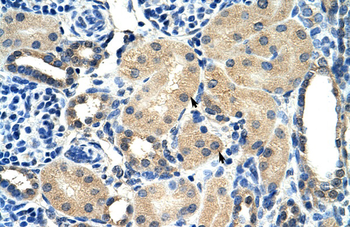 AIP Rabbit Polyclonal Antibody