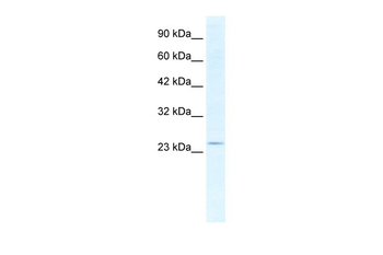 SOX14 Rabbit Polyclonal Antibody