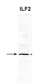 ILF2 Rabbit Polyclonal Antibody
