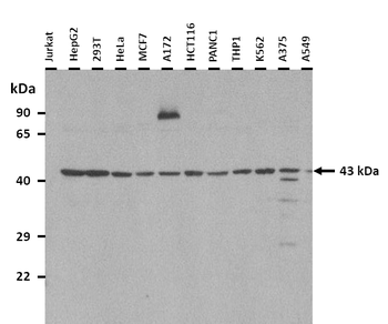 ILF2 Rabbit Polyclonal Antibody