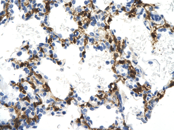 NMI Rabbit Polyclonal Antibody