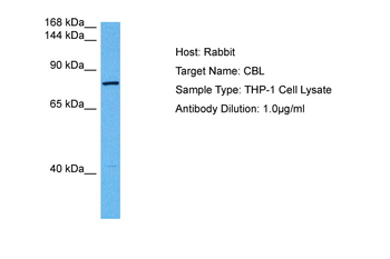 CBL Rabbit Polyclonal Antibody
