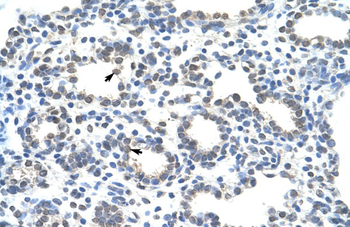 ZRANB2 Rabbit Polyclonal Antibody