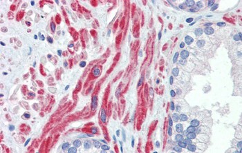 SSX4 Rabbit Polyclonal Antibody