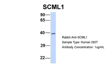 SCML1 Rabbit Polyclonal Antibody