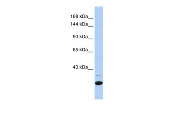 ZNF197 Rabbit Polyclonal Antibody
