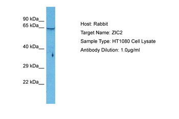 ZIC2 Rabbit Polyclonal Antibody