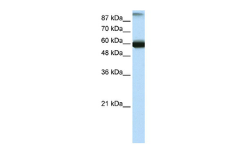 GTF3C5 Rabbit Polyclonal Antibody