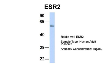 ESR2 Rabbit Polyclonal Antibody