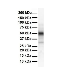 ESR2 Rabbit Polyclonal Antibody