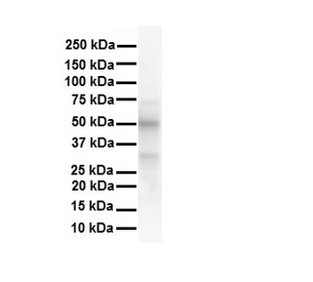 ESR2 Rabbit Polyclonal Antibody