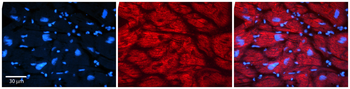 MLXIP Rabbit Polyclonal Antibody