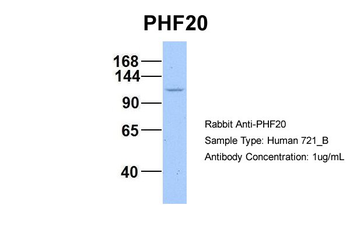 PHF20 Rabbit Polyclonal Antibody
