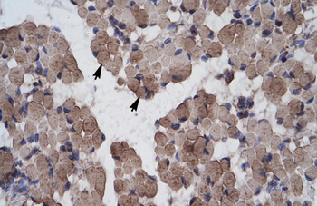 LHX9 Rabbit Polyclonal Antibody