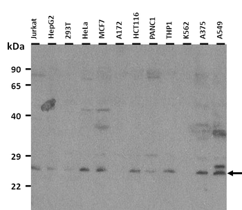 HES4 Rabbit Polyclonal Antibody