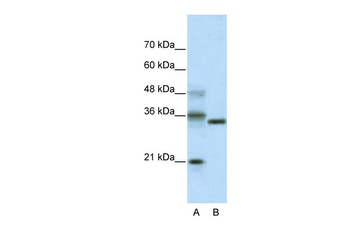 HES4 Rabbit Polyclonal Antibody