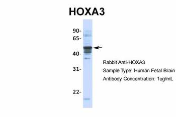 HOXA3 Rabbit Polyclonal Antibody