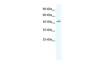 DMRTB1 Rabbit Polyclonal Antibody