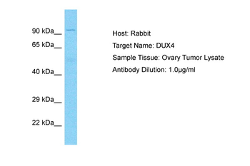 DUX4 Rabbit Polyclonal Antibody