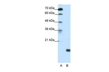 TGIF2LY Rabbit Polyclonal Antibody