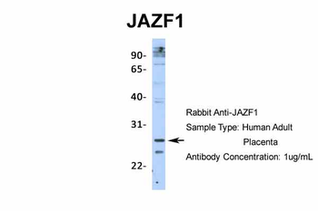 JAZF1 Rabbit Polyclonal Antibody