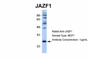 JAZF1 Rabbit Polyclonal Antibody