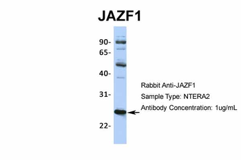 JAZF1 Rabbit Polyclonal Antibody