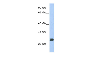 JAZF1 Rabbit Polyclonal Antibody