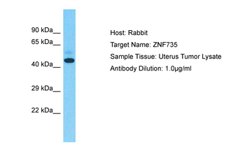 ZNF735 Rabbit Polyclonal Antibody