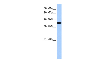AKAP7 Rabbit Polyclonal Antibody