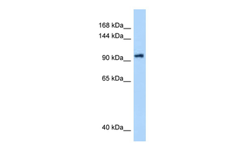 DHX16 Rabbit Polyclonal Antibody