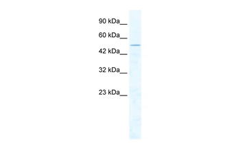 CHD1L Rabbit Polyclonal Antibody
