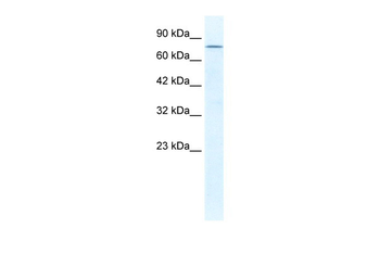 DDX23 Rabbit Polyclonal Antibody