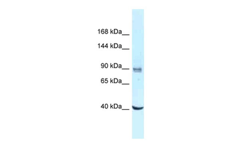 DDX23 Rabbit Polyclonal Antibody
