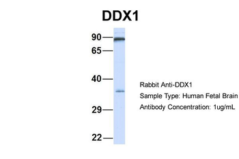 DDX1 Rabbit Polyclonal Antibody