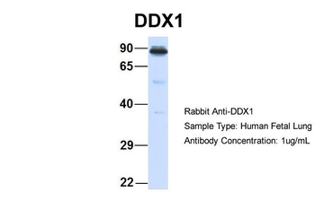 DDX1 Rabbit Polyclonal Antibody