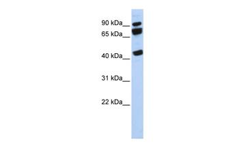 DDX17 Rabbit Polyclonal Antibody