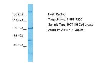 SNRNP200 Rabbit Polyclonal Antibody