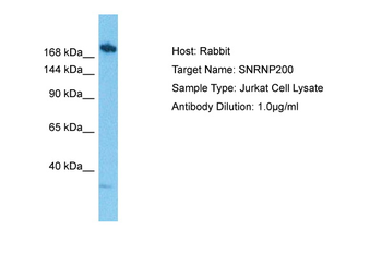 SNRNP200 Rabbit Polyclonal Antibody