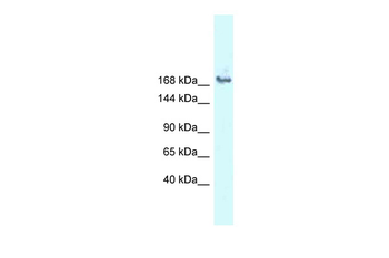 SNRNP200 Rabbit Polyclonal Antibody