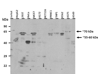 DDX41 Rabbit Polyclonal Antibody