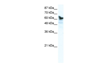 DDX41 Rabbit Polyclonal Antibody
