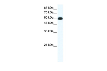 DDX27 Rabbit Polyclonal Antibody