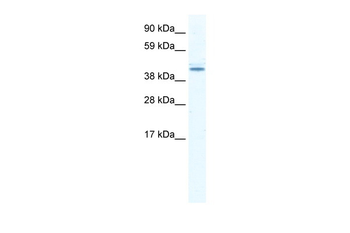 DDX49 Rabbit Polyclonal Antibody