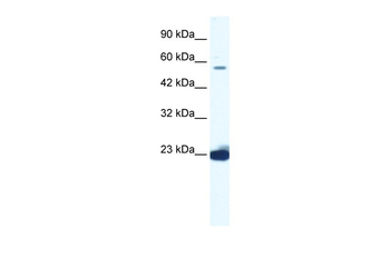 DDX55 Rabbit Polyclonal Antibody