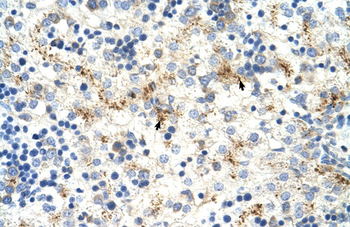 MOV10 Rabbit Polyclonal Antibody