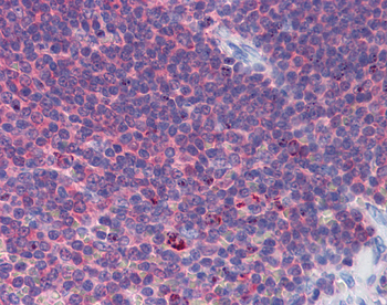 IFIH1 Rabbit Polyclonal Antibody