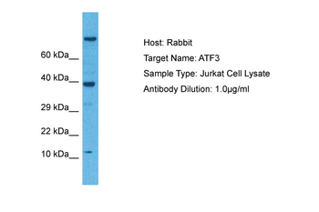 ATF3 Rabbit Polyclonal Antibody